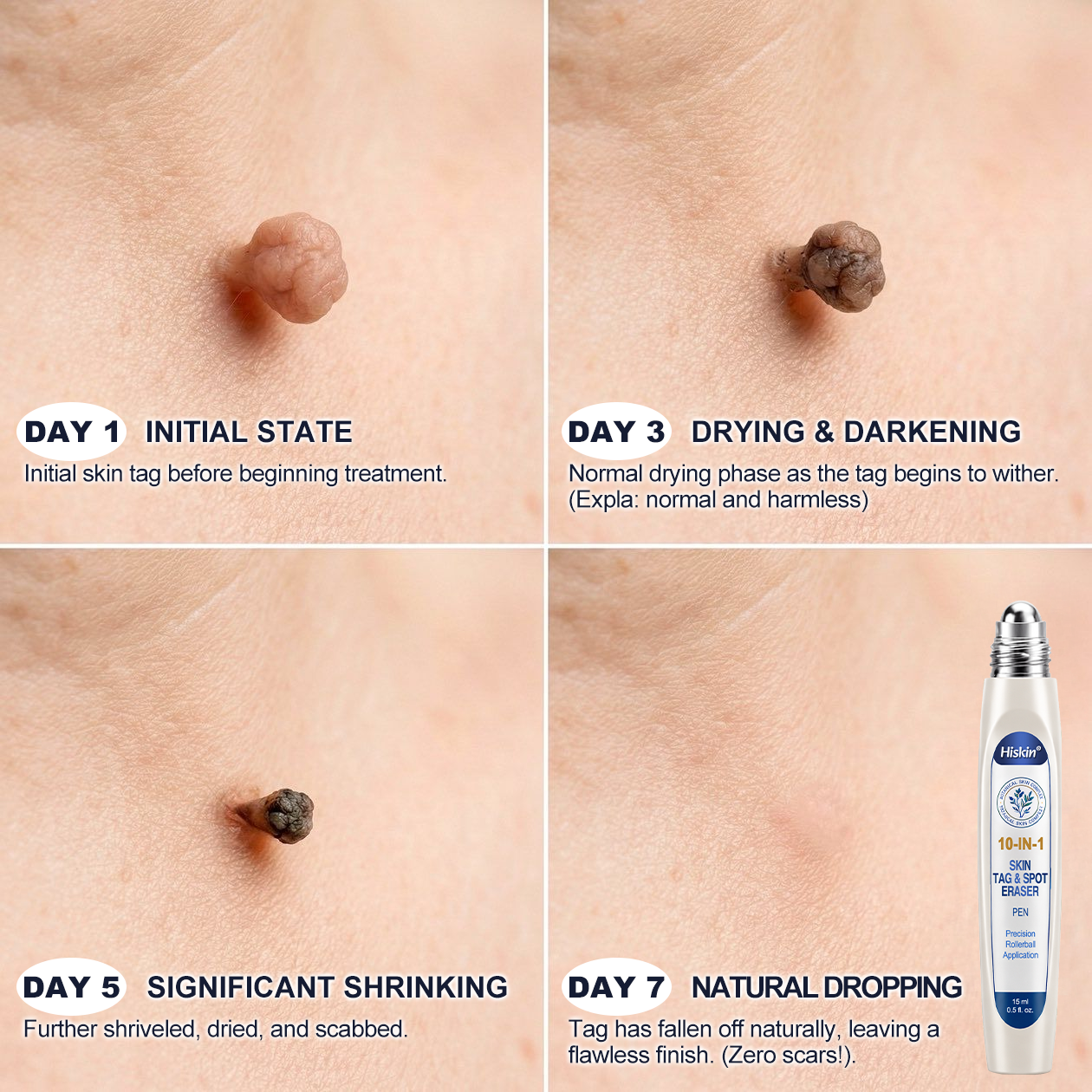 👩‍⚕️ 👩‍⚕️𝑯𝒊𝒔𝒌𝒊𝒏® 𝑮𝑯𝑲-𝑪𝒖 10-IN-1 Skin Renewal Pen | 7-Day Advanced Skin Care | Copper Peptide + Peptide Technology | Helps Improve Fine Lines, Dullness & Uneven Texture