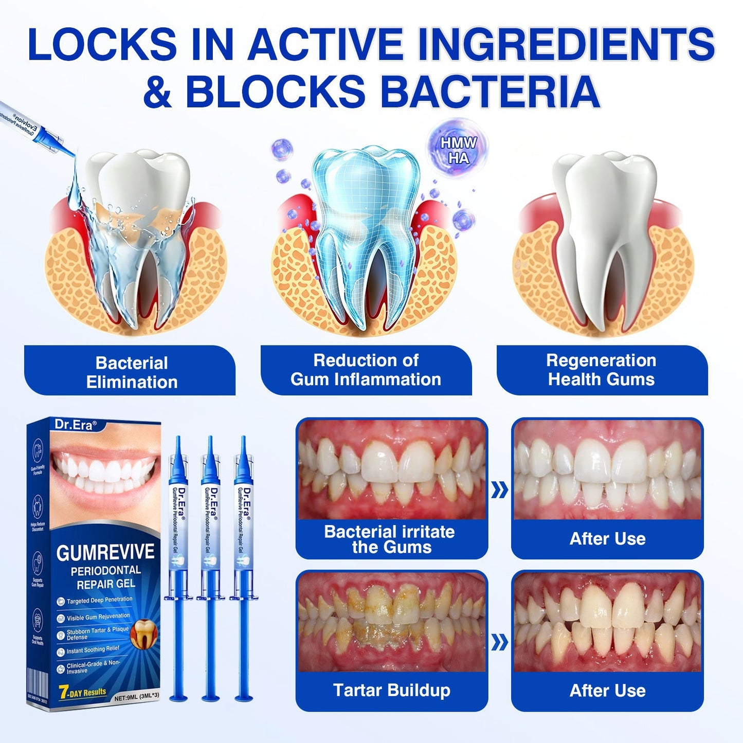 🇨🇦🏅🦷🛡️Dr.Era® GumRevive Periodontal Repair Gel