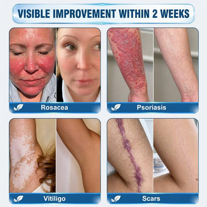 👩‍⚕️ 👩‍⚕️𝑯𝒊𝒔𝒌𝒊𝒏® 𝑮𝑯𝑲-𝑪𝒖 10-IN-1 Skin Renewal Pen | 7-Day Advanced Skin Care | Copper Peptide + Peptide Technology | Helps Improve Fine Lines, Dullness & Uneven Texture