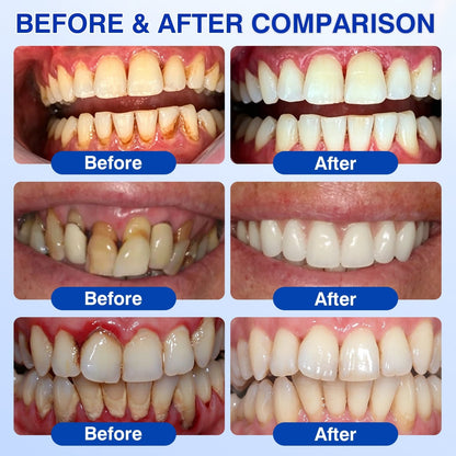 🇨🇦🏅🦷🛡️Dr.Era® GumRevive Periodontal Repair Gel