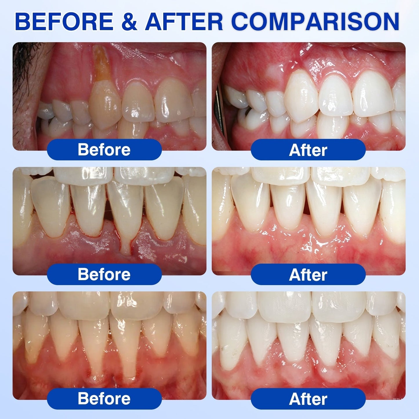 🇨🇦🏅🦷🛡️Dr.Era® GumRevive Periodontal Repair Gel