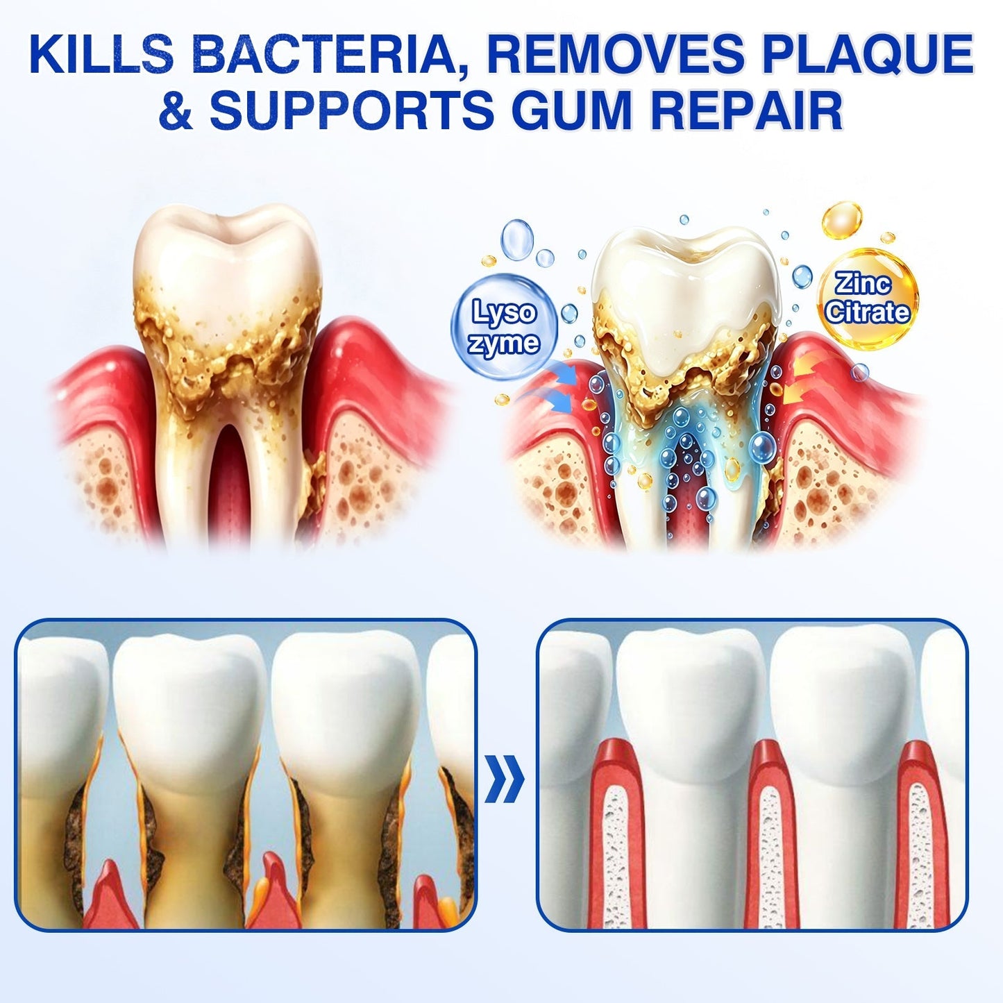 🇨🇦🏅🦷🛡️Dr.Era® GumRevive Periodontal Repair Gel