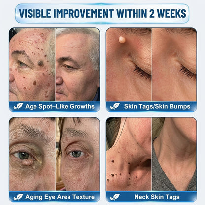 👩‍⚕️ 👩‍⚕️𝑯𝒊𝒔𝒌𝒊𝒏® 𝑮𝑯𝑲-𝑪𝒖 10-IN-1 Skin Renewal Pen | 7-Day Advanced Skin Care | Copper Peptide + Peptide Technology | Helps Improve Fine Lines, Dullness & Uneven Texture