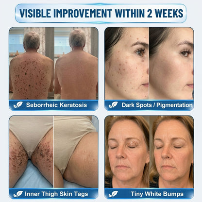 👩‍⚕️ 👩‍⚕️𝑯𝒊𝒔𝒌𝒊𝒏® 𝑮𝑯𝑲-𝑪𝒖 10-IN-1 Skin Renewal Pen | 7-Day Advanced Skin Care | Copper Peptide + Peptide Technology | Helps Improve Fine Lines, Dullness & Uneven Texture