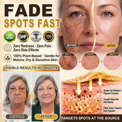 🎁SURPRISE! Hiskin® just unlocked an INCREDIBLE 30% OFF your next order! 🎉 This exclusive offer is yours for the next TWO MINUTES ONLY – don’t miss your chance to save BIG!